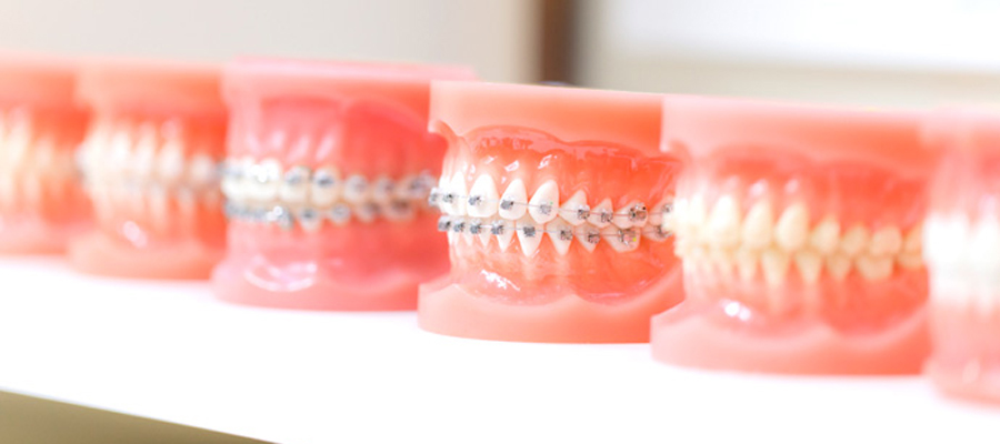 Orthodontic Treatment in Turkey