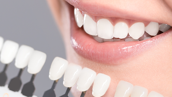 Porcelain Laminate Tooth – Leaf Porcelain Teeth